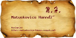 Matuskovics Hannó névjegykártya